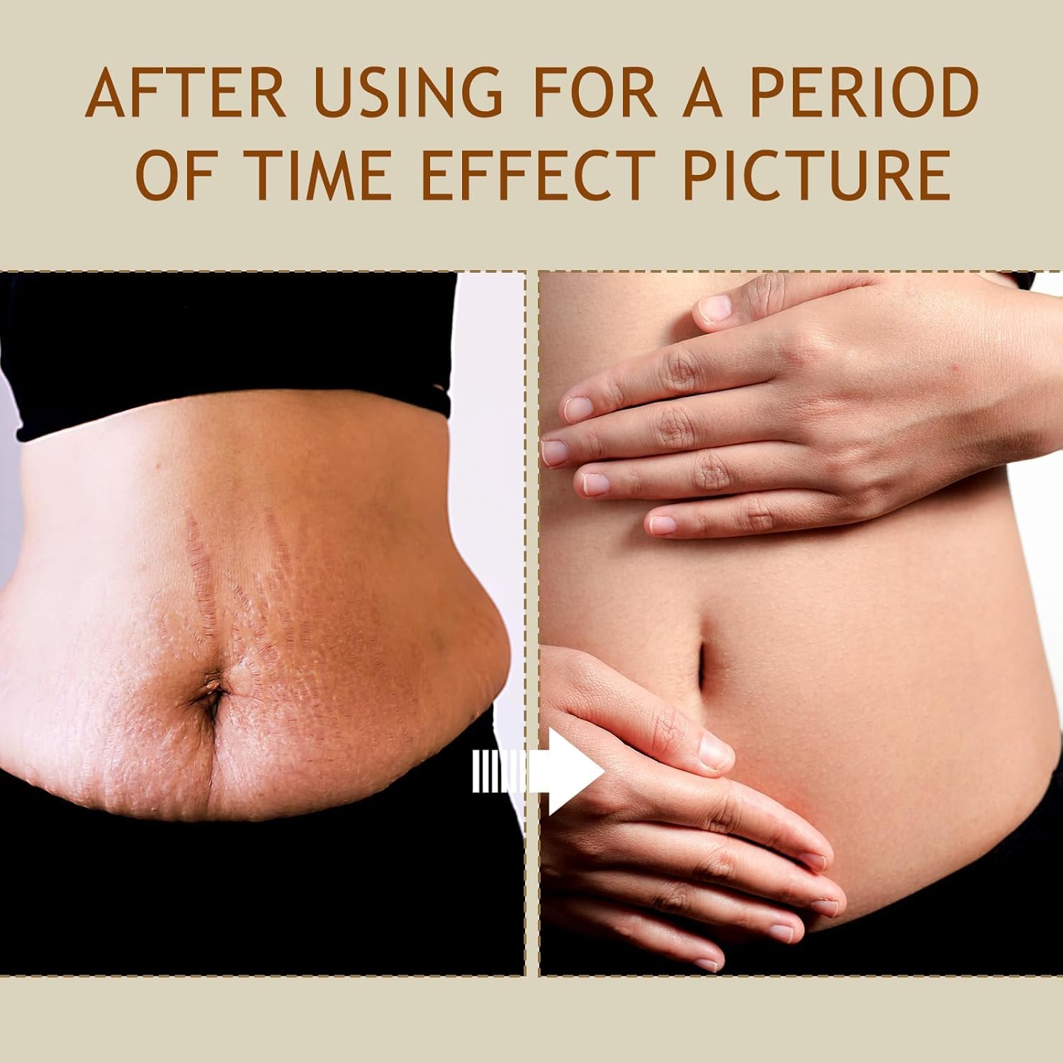 B Flat Belly Firming Cream - Stretch Mark Treatment - Clean and Gentle Belly Cream - Skin Tightening Cream for Cellulite for Stomach Mark & Thighs & Butt, Moisturizing Lifting Body Lotion-Velvo Beauty