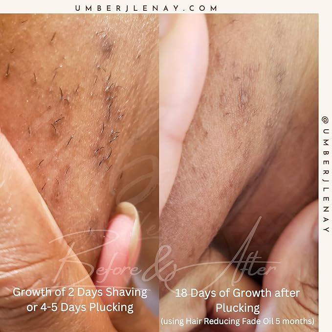 Hair Reducing Fade Oil – Regular Strength (Not sensitive skin), Minimizes Hair Growth for Face & Body – For Women & Men – 15ml Serum-Velvo Beauty