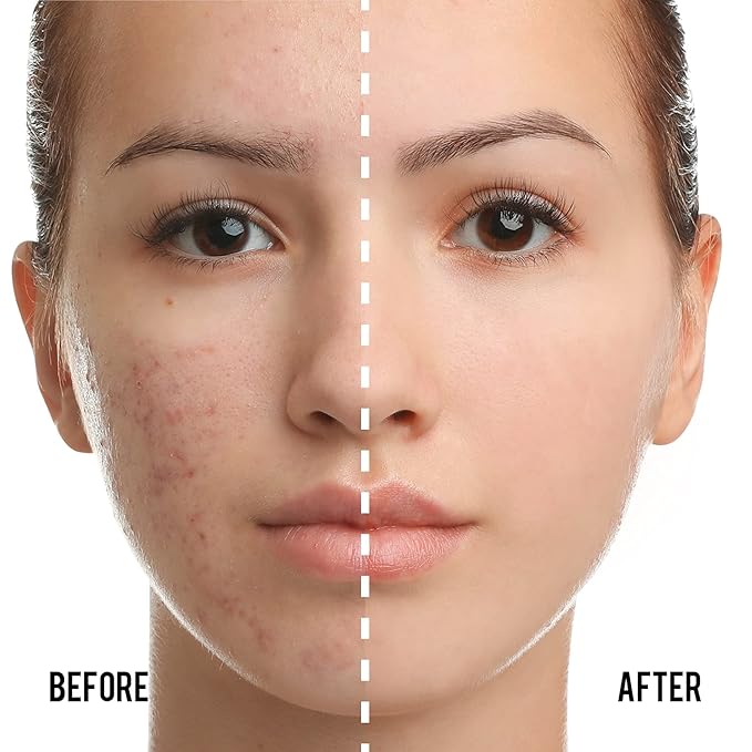 Catkin Phoenix Cushion Foundation Buildable Coverage Anti-Aging Serum Makeup, Sheer Satin Finish, Refill Included, Light Beige 0.46 Oz x 2, C01 NATURAL-Velvo Beauty