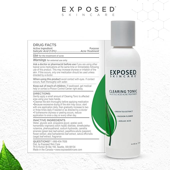 Exposed Skin Care Acne Treatment Kit - Includes Facial Cleanser, Clearing Tonic, Acne Treatment Serum, Clear Pore Serum, Clarifying Mask, Cloth - Natural Acne Solution for Face, All Ages & Skin Types-Velvo Beauty