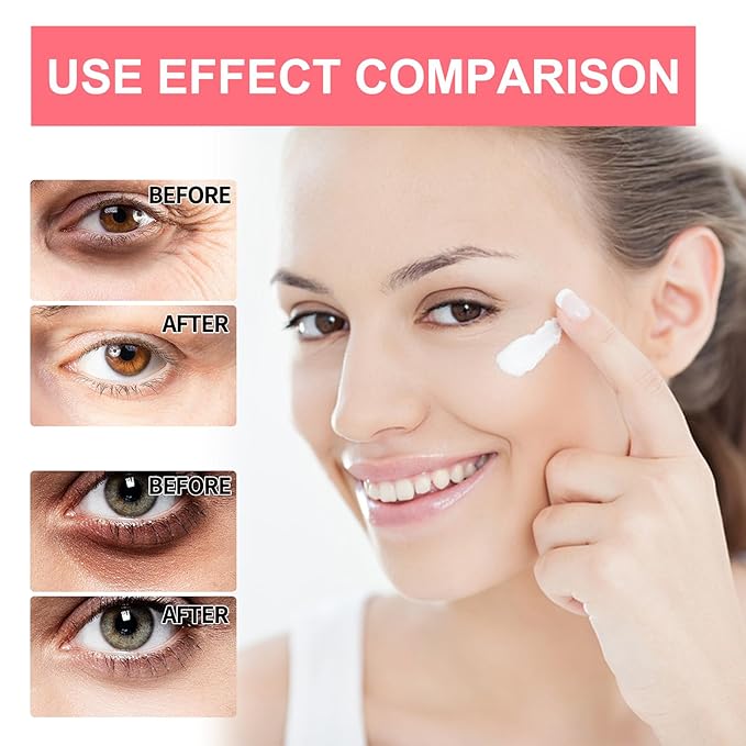 Retinol Eye Serum Stick, Retinol Eye Cream and Gel, Anti-Aging Eye Treatment-Velvo Beauty