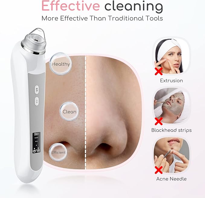 Blackhead Remover Vacuum, Black Head Remover for Face with Camera, Pore Vacuum for Men and Women, USB Interface Type Blackhead Remover Tools, 6 Suction Heads & 3 Adjustment Modes (Grey)-Velvo Beauty