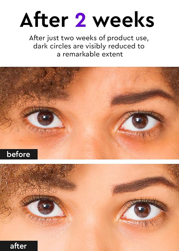 Bewants Eye Cream Stick for Wrinkles | Under Eye Cream For Dark Circles and Puffiness | Eye Cream for Puffiness and Bags Under Eyes | Hydrating Eye Cream for Sensitive Skin | Korean Skincare-Velvo Beauty