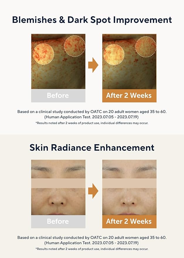 AROMATICA Glow Vita C Toning Serum Orange & Neroli 30ml/1.01 fl. oz - Orange Vitamin C Serum for Face with Hyaluronic Acid For Sensitive Skin-Velvo Beauty