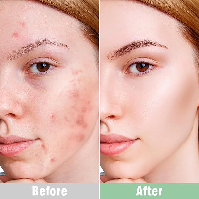 ISTON Overnight Hydrogel Face Mask for All Skin-Velvo Beauty