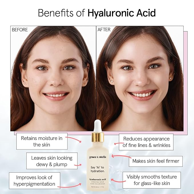 grace & stella Award Winning Hyaluronic Acid Serum (10ml/0.34 fl oz) Hyaluronic Acid Serum for Face - Acido Hialuronico Face Serums for Women - Hydrating, Remove Fine Lines, Wrinkles - Anti Aging-Velvo Beauty