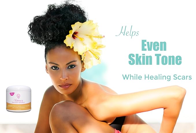 Best Stretch Marks Cream Prevent & Reduce Marks Reduce Pregnancy Stretch Marks Highly Concentrated Cream includes $29 Scar Reducing Guide-Velvo Beauty