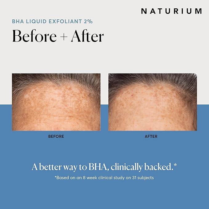 Naturium BHA Liquid Exfoliant 2%, Leave-on Face & Skin Care Exfoliating Pore Treatment, with Salicylic Acid & Bioactive Fruit Acids, Packaging May Vary, 4 oz-Velvo Beauty