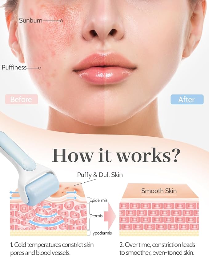 MORGLES Ice Roller for Face, Premium Facial Roller for Puffiness, Dark Circles and Lymphatic Drainage, Cold Face Roller for Women Self Care with Carry Case-Velvo Beauty