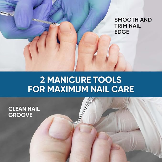 Ingrown Toenail Treatment, 60Pcs Ingrown Toenail Corrector Strips, Ingrown Toenail Removal Kit with File and Lifter, 60Pcs-Velvo Beauty