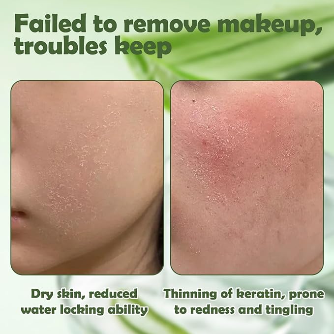 Total Takeoff Waterproof Makeup Remover – Dual-Phase Oil & Water Formula, Removes Eye & Lip Makeup, Gentle for Sensitive Skin, Aloe & Argan Oil, No-Rinse, 3.4 fl oz/100ml-Velvo Beauty