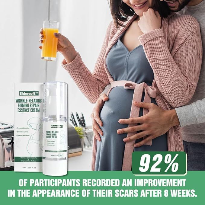 Wrinkle-Relaxing Firming Repair Essence Cream - Removes Maternity Stretch Marks, Prevents Wrinkles & Fine Lines, Nourishes & Rejuvenates Skin with Safe, Natural Formula-Velvo Beauty