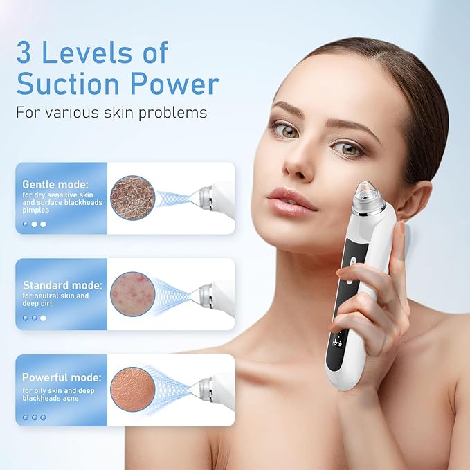 Facial Pore Blackhead Remover Vacuum, 1080P Camera Blackhead Remover, 20x Zoom, 8 LEDs ＆ 3 Suction Modes, 800mAh Battery & USB - 6 Heads Pore Cleaner Kit for Women&Men(Black)-Velvo Beauty