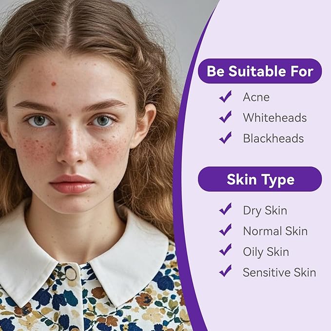 Overnight Pimple Patches for Face - Maximum Strength Hydrocolloid for Cystic Acne & Dark Spots (72 Count) - 10mm & 12mm Medicated Night Time Treatment-Velvo Beauty