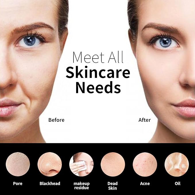 Silicone Face Scrubber, NågraCoola CLIE 2.0 Facial Cleansing Brush, Rechargeable, Waterproof Face Scrub Brush for Cleansing, Exfoliating, Massaging, Electric Facial Exfoliator for Women & Men - Black-Velvo Beauty