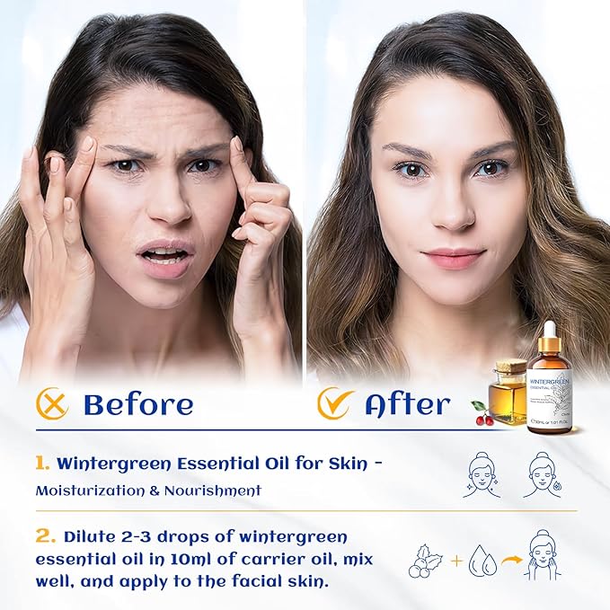 HIQILI 1 Fl Oz Wintergreen Essential Oil, 100% Pure Natural for Skin, Diffuser - 30ml-Velvo Beauty