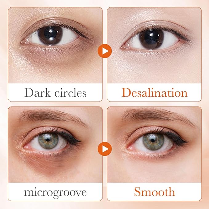 Eye Cream For Dark Circles, Vitamin C Eye Cream For Dark Circles, Puffiness and Bag, Anti Aging Eye Cream Firming Skin, Reduces Fine Lines, Moisturizing Eye Cream for Dry Skin around Eyes-Velvo Beauty