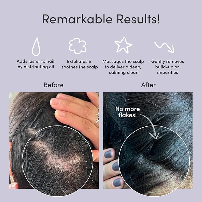 Jupiter Scalp Exfoliator Brush, Detangling Scalp Scrubber Brush, for Wet or Dry Hair, Removes Dandruff & Build-Up, Supports Circulation, Ergonomic Scalp Massager, Good for All Hair Types, White-Velvo Beauty