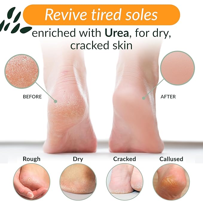 Tree to Tub Foot Cream for Dry Cracked Heels and Feet - Foot Lotion for Dry Cracked Feet, Non-Greasy Moisturizer Urea Cream w/Softening Shea Cocoa Butter, Citrus Foot Care for Women & Men-Velvo Beauty