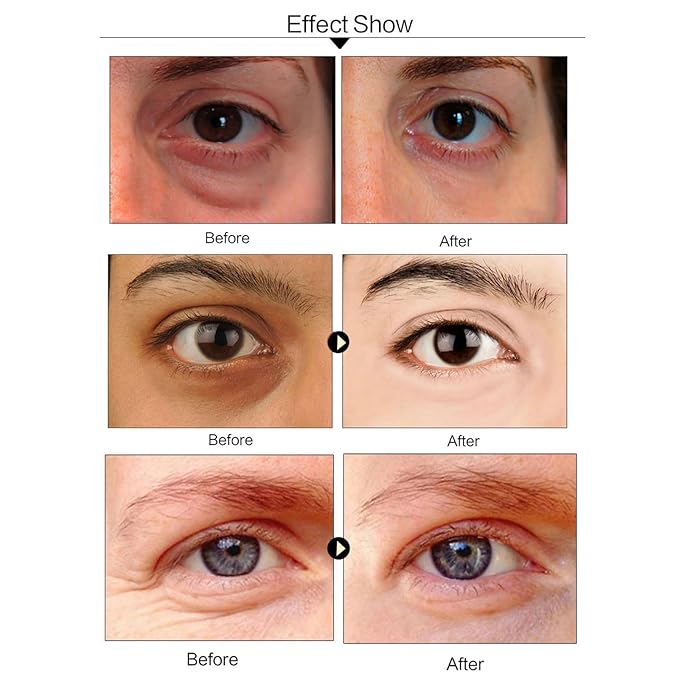 Under Eye Patches, 24K Gold Collagen Eye Mask for Puffy Eyes and Dark Circles Treatment, Under Eye Mask for Bags and Wrinkles, Eye Skin Care Pads for Beauty & Personal Care (60Pcs)-Velvo Beauty