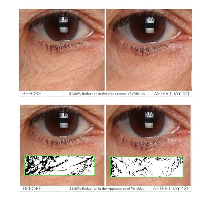 Serious Skincare - C3 Vitamin C Ester Eye Beauty Treatment with Hyaluronic Acid - For Dull & Dry Under Eyes - Soothing C3 Plasma Gel Formula for Fine Lines, Wrinkles, Discoloration - 0.5 oz.-Velvo Beauty