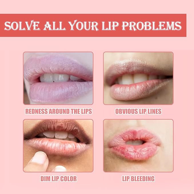 3 PCS Bee Lip Balm Honey Pot, Exfoliating Honey Strawberry Watermelon Lip Mask Overnight with Built-In Brush, Hydrating Prevention Dry and Crack Lip Scrubs Exfoliator Lip Wrinkle Care-Velvo Beauty