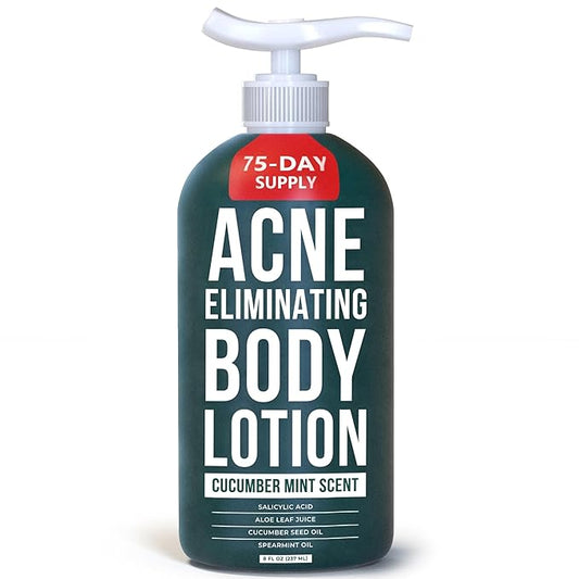 TreeActiv Acne Eliminating Body Lotion 8 fl oz | Clears Body, Back, Butt and Shoulder Acne | Anti-Acne Moisturizer | Prevents Future Breakouts | Cucumber Mint Scent-Velvo Beauty