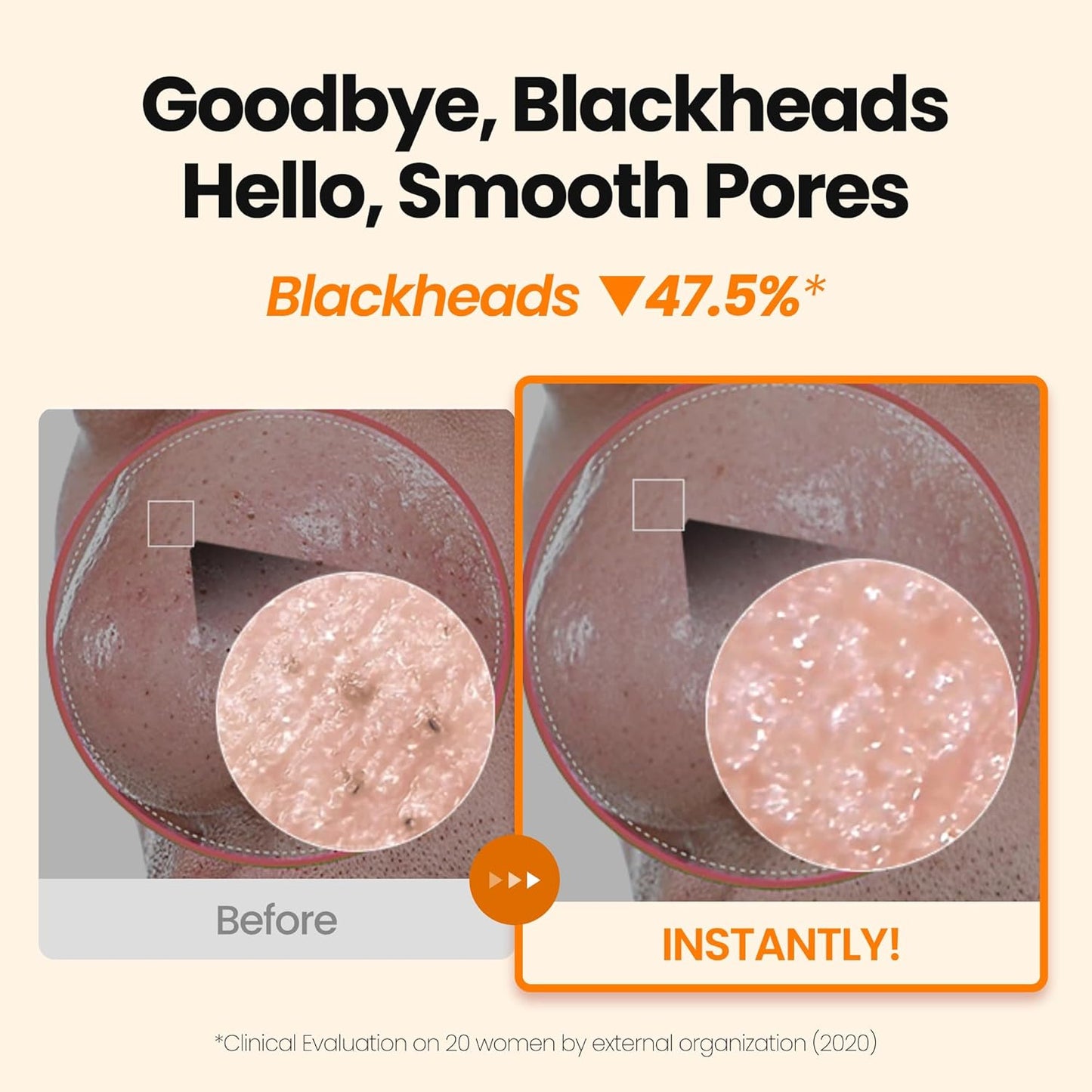 [K-Beauty] Calendula Biome Oil to Foam - All-in-One Korean Face Wash OilBased Foaming Facial Cleanser - Hydrating, Moisturizing & Soothing Makeup Deep Cleansing Oil for All Skin Types (3.88 fl oz)-Velvo Beauty