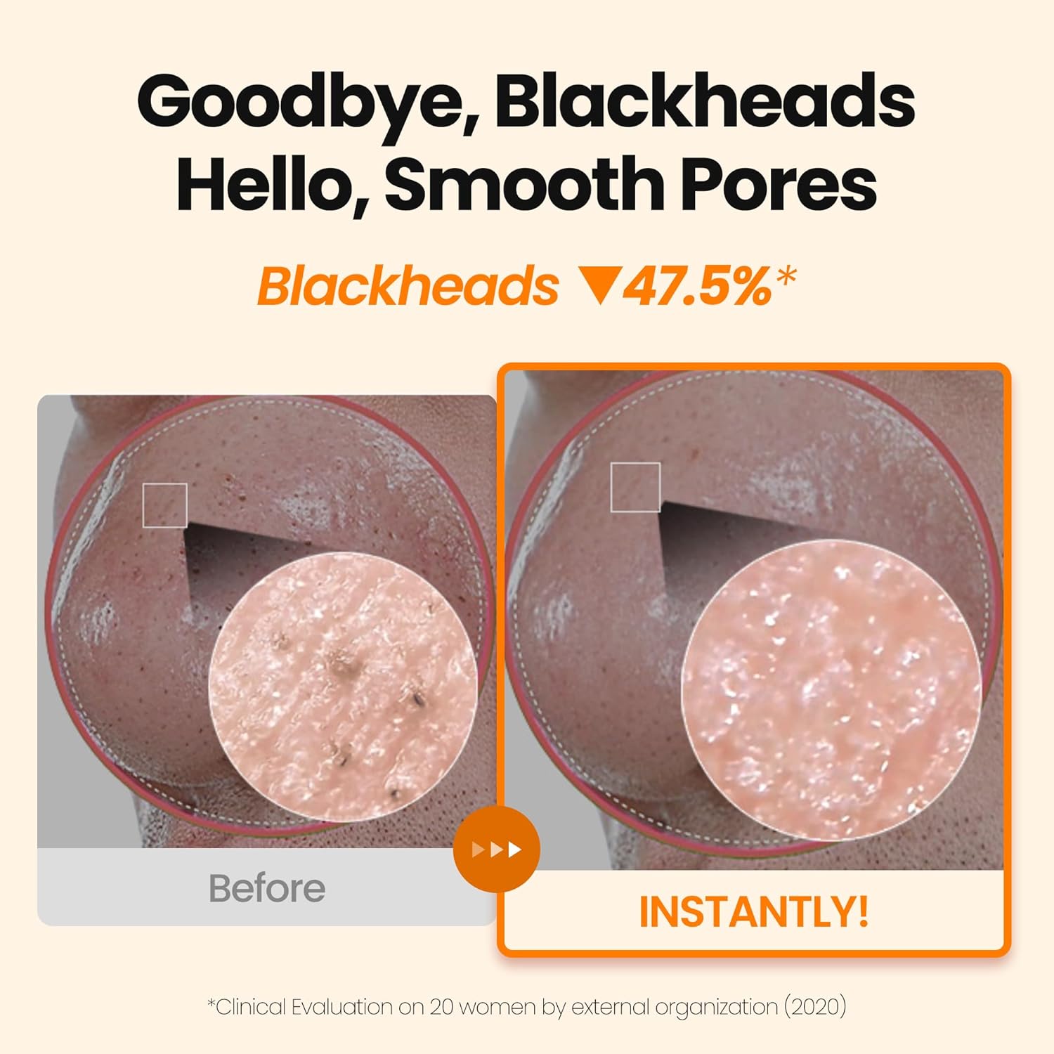 [K-Beauty] Calendula Biome Oil to Foam - All-in-One Korean Face Wash OilBased Foaming Facial Cleanser - Hydrating, Moisturizing & Soothing Makeup Deep Cleansing Oil for All Skin Types (3.88 fl oz)-Velvo Beauty