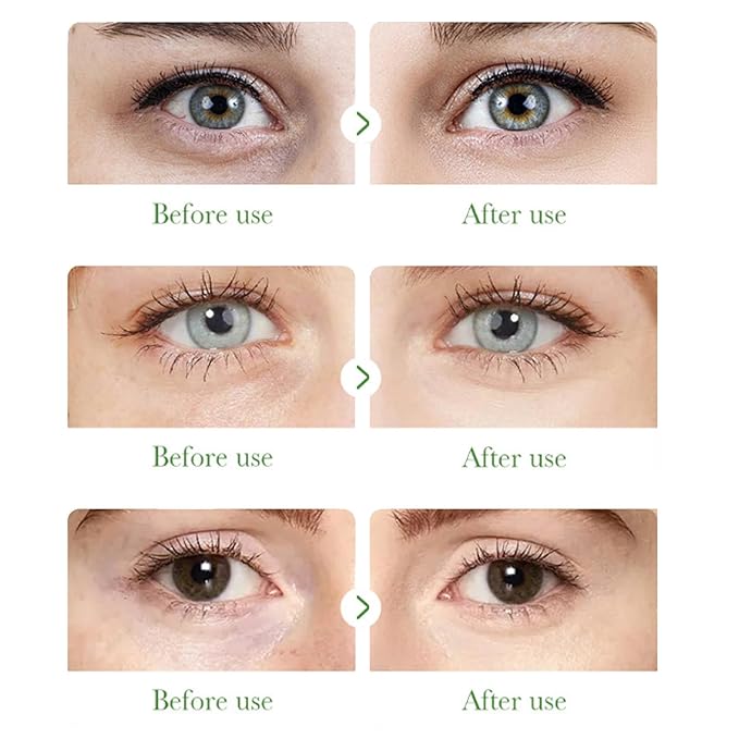 Aloe Vera Under Eye Mask,60 PCS Aloe Vera Gel Eye Mask Skin Care,Hyaluronic Acid Collagen Under Eye Patches for Dark Circles and Puffiness,Reduce Wrinkle Patches,Improves & Firms Eye Skin-Velvo Beauty