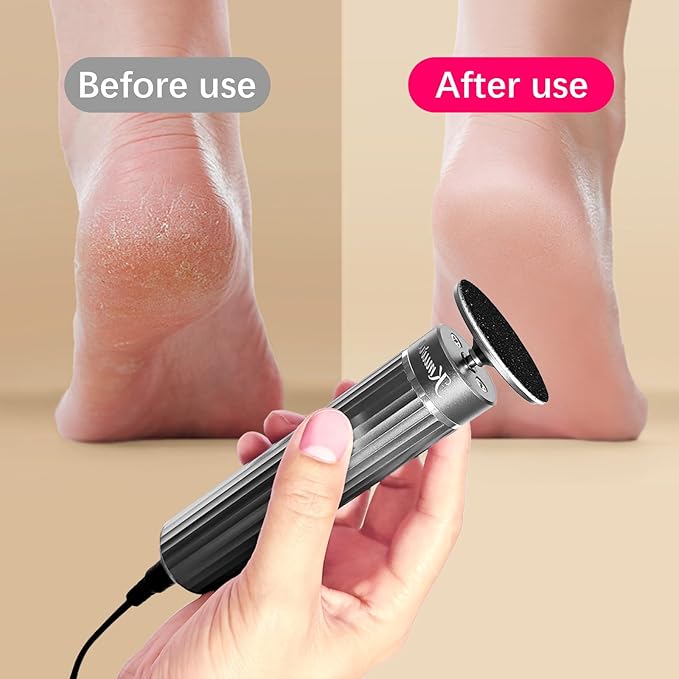 5.3'' Electric Foot Callus Remover with 80pcs Sandpaper Discs & Brush, Professional Aluminum Ergonomic Pedicure Tool, Stepless Speed & Reverse Control for Dead Skin Removal (Grey)-Velvo Beauty