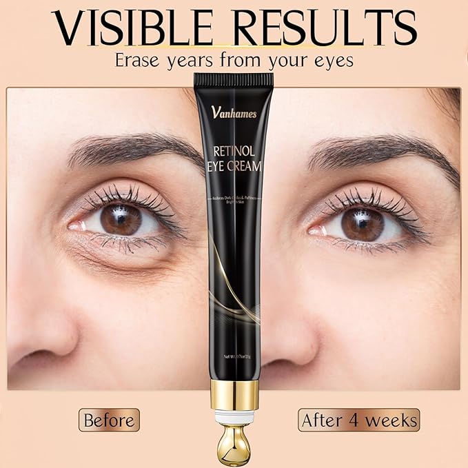 Retinol Caffeine Eye Cream, Under Eye Cream for Dark Circles and Puffiness, Anti Aging Eye Cream for Wrinkles, Eye Bags Treatment for Men and Women, 20g (Fragrance Free)-Velvo Beauty