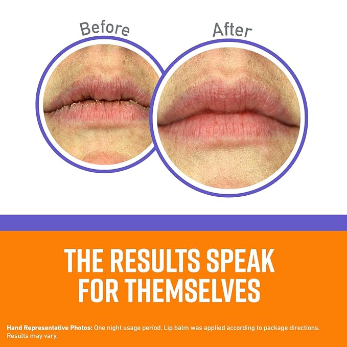 O'Keeffe's Lip Repair Night Treatment Lip Balm, 0.25 Ounce Jar, (Pack of 1)-Velvo Beauty