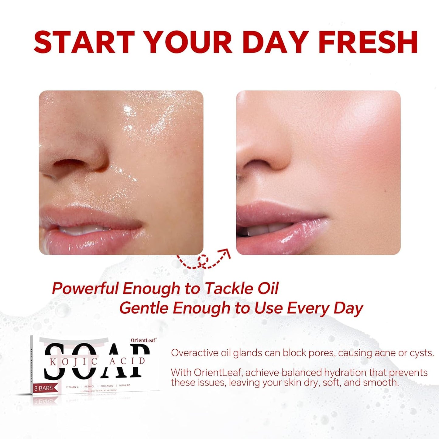 Kojic Acid Soap, Turmeric Soap Bar for Dark Spots, Fresh Citurs Scent, Gentle for Face and Body Wash with Vitamin C, Shea Butter, Retinol, Olive Oil, Collagen (3 PACK)-Velvo Beauty