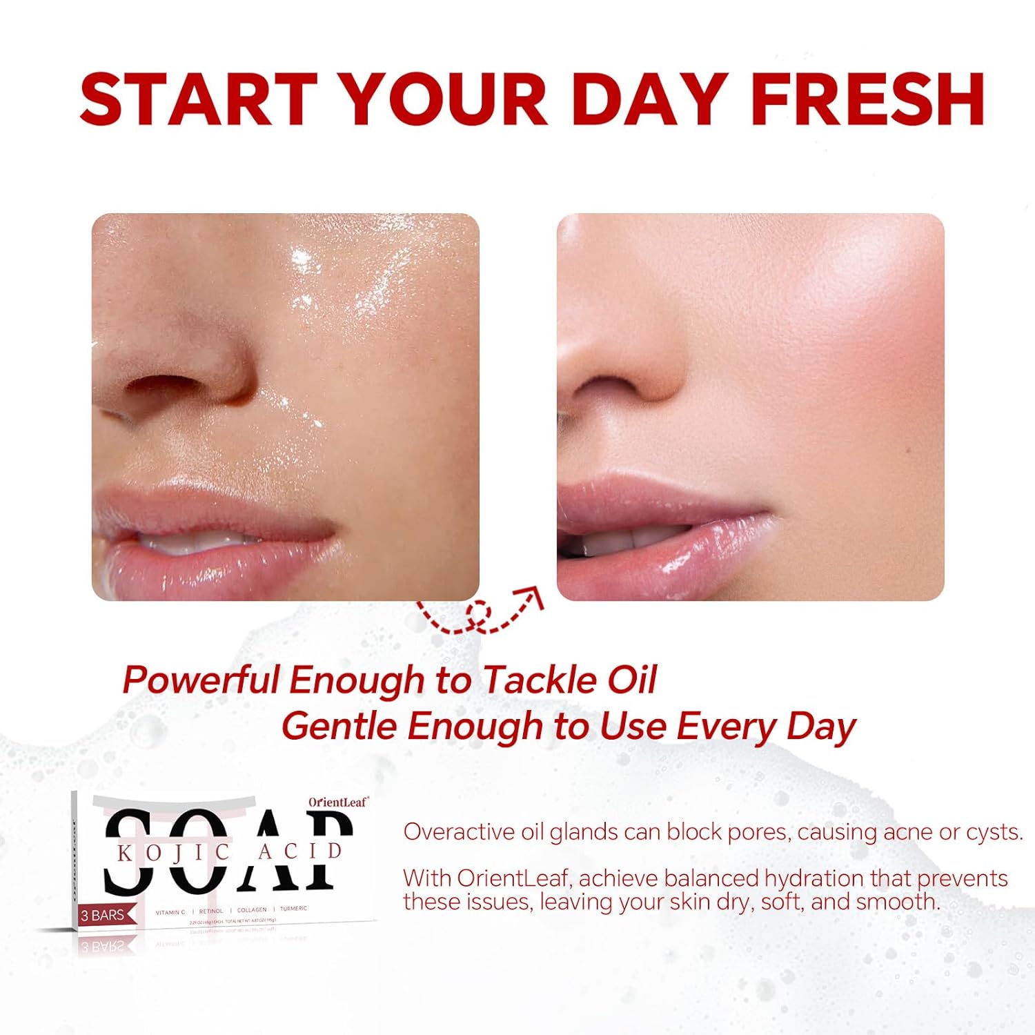 Kojic Acid Soap, Turmeric Soap Bar for Dark Spots, Fresh Citurs Scent, Gentle for Face and Body Wash with Vitamin C, Shea Butter, Retinol, Olive Oil, Collagen (3 PACK)-Velvo Beauty