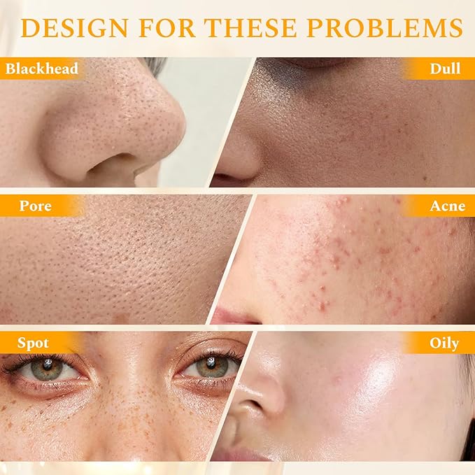 Vitamin C Face Scrub Face Exfoliator Cream Brightening Facial Scrub Exfoliating Facial Wash Microdermabrasion Facial Scrub, Gently Exfoliate Dirt and Dead Skin Cells, Improve Dark Spot, 140g/5oz-Velvo Beauty