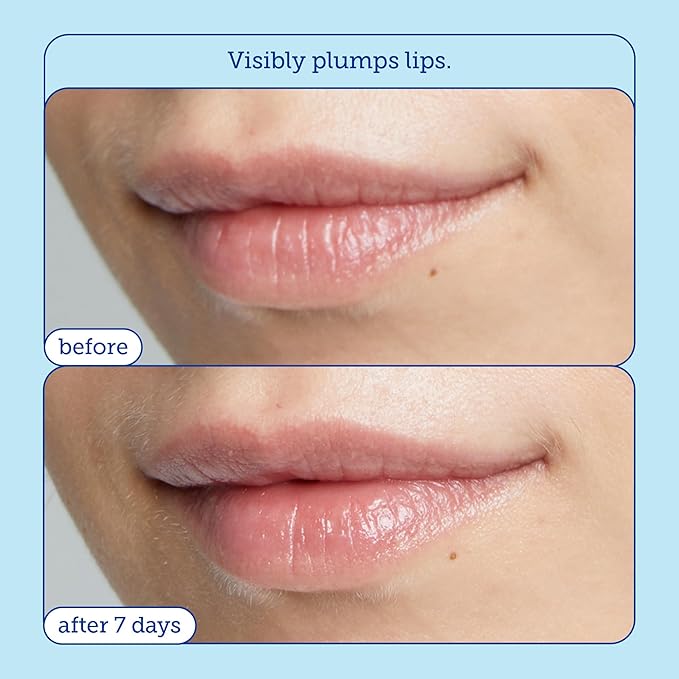 Skinfix Barrier+ Triple Lipid Lip Treatment: Nourish Dry, Chapped Lips With Our Volumizing Complex to Visibly Plump & Fill Fine Lines, 0.27 Oz-Velvo Beauty
