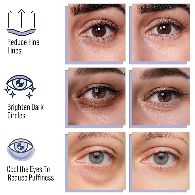 DIAMOND GAZE Under Eye Patches 28 Pairs, Rejuvenate Eye Area, Soothing Hydrate Brighten Skin, Plumps Fine Lines, Hydrogel Eye Mask with Retinol, Niacinamide and Polyglutamic Acid, Eye Gel Pads-Velvo Beauty