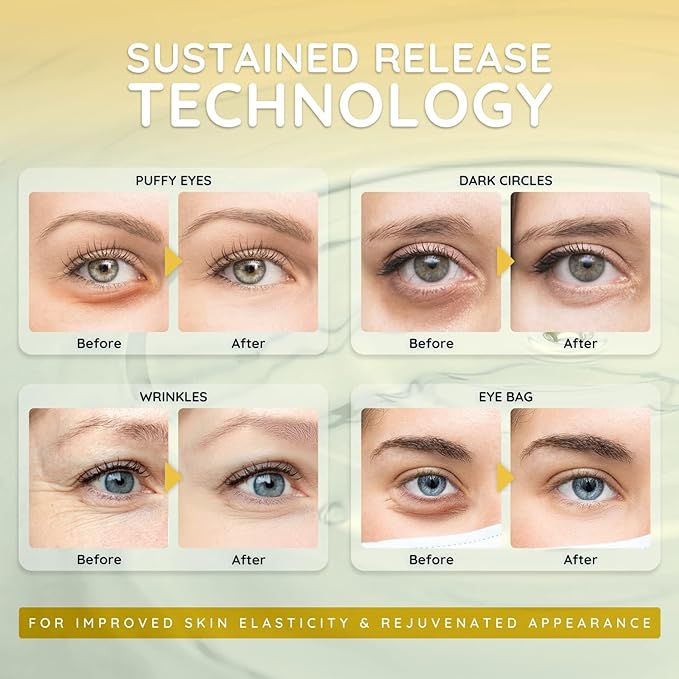 Enaskin Naturals Under Eye Patches for Dark Circles: Premium Gels Pads - Reduce Eye Bags, Wrinkles & Puffy - Skin Treatment Advanced Mask - Anti Aging & Face Moisturizer For Women, 10 Pairs (Black)-Velvo Beauty