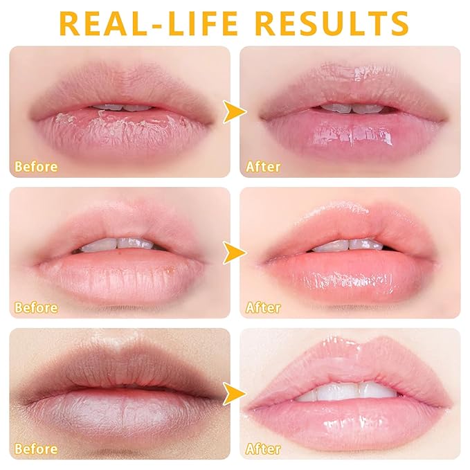 5 PCS Bee Balm Lip Balm Lip Mask Honey Pot, Lip Mask Propolis Moisturizing Lip Balm, Hydrating Prevention Dry and Cracked Lip Scrubs Exfoliator Lip Care (Strawberry&Watermelon&Honey&Apple Lime&Cherry)-Velvo Beauty