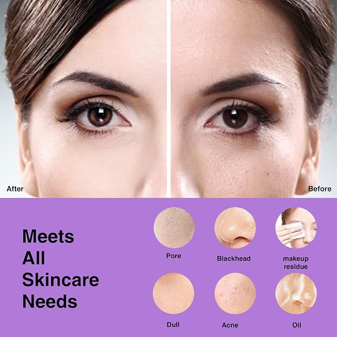 NgraCoola CLIE Facial Cleansing Brush - Waterproof & Rechargeable Face Scrubber for Men & Women, Cleansing, Exfoliating & Massaging - Violet-Velvo Beauty