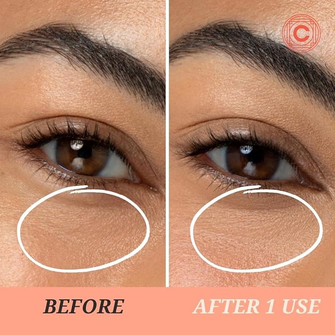 Lights On Brightening Dissolvable Eye Mask Infused with Red Algae, Vitamin C, Peptides, and Black Mulberry - Under Eye Patches for Wrinkles, Dark Circles, Puffiness, and Signs of Aging-Velvo Beauty