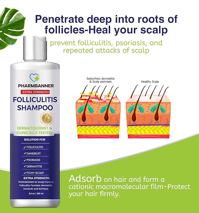 Anti-Fungal Shampoo for Itchy, Dry Scalp – Supports Scalp Health, Helps with Folliculitis, Seborrheic Dermatitis & Scalp Flaking-2 Pack-Velvo Beauty