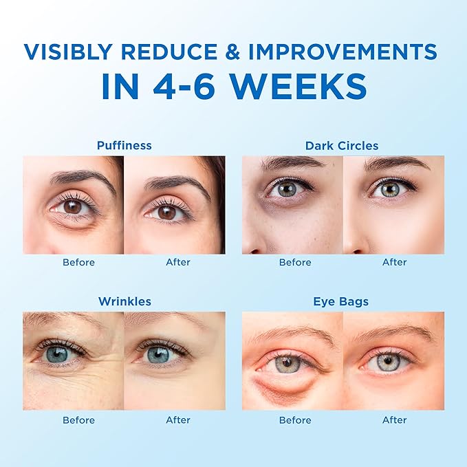 Eye Patches for Puffy Eyes 60 Pcs, 24k Gold Under Eye Patches for Dark Circles and Puffiness, Under Eye Mask Patches for Wrinkles, Dark Circles Under Eye Bags Treatment For Women And Men-Velvo Beauty