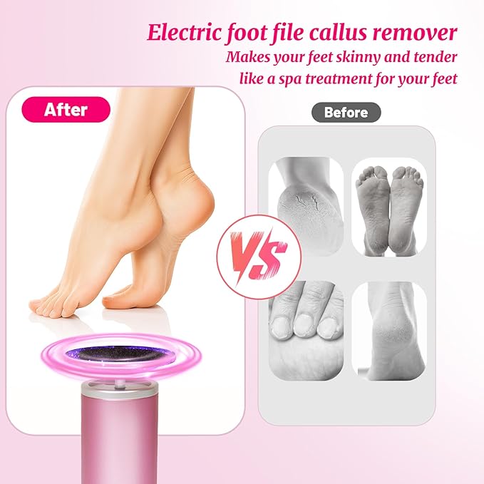 Electric Foot Callus Remover with 80pcs Sandpape Discs, Professional 800RPM Aluminum, Callus Remover for Feet Pedicure Tool for Dead Skin and Calluses, Stepless Speed Control Foot File 2 in 1-Velvo Beauty