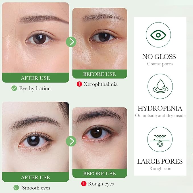 BIOAQUA Centella Asiatica Nourish Repair Eye Cream Soothing Oil Control Anti-Acne 20g / 0.7oz-Velvo Beauty