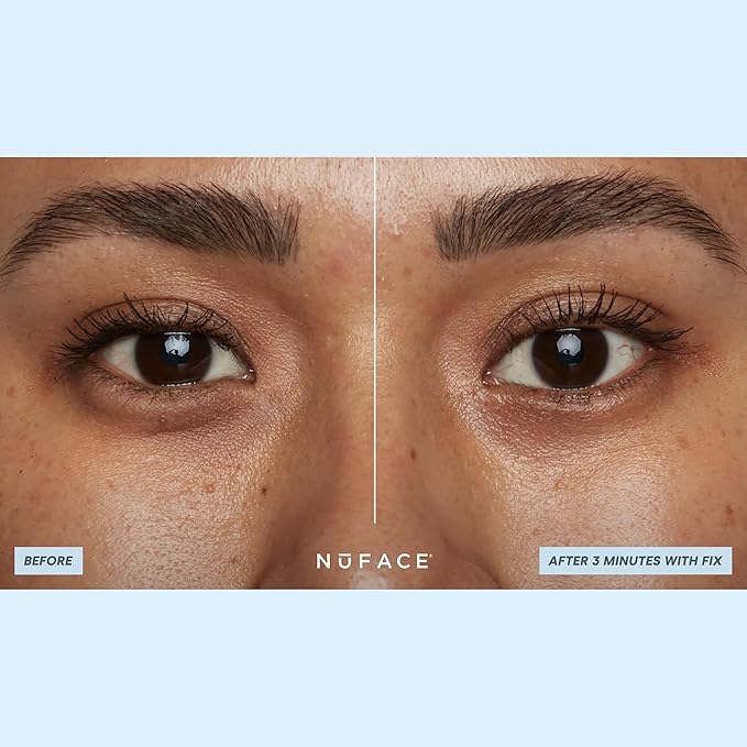 NuFACE IonPlex Hydra-Gel Power Under Eye Patches - Gel Under Eye Mask for Puffy Eyes & Dark Circles - Cooling Wrinkle Patches & Hydrating Treatment Pads to Energize, Brighten & Tighten (60 Count)-Velvo Beauty