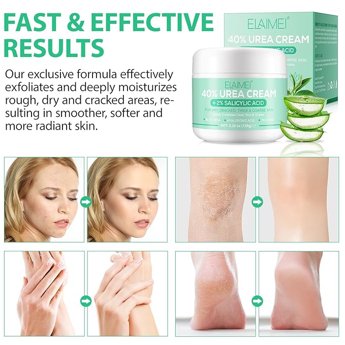 J&H Jasmine&Hyacinth 40% Urea Cream with 2% Salicylic Acid, Aloe, Feet/Heel Cream Moisturizer for Dry Cracked Heel, Knees, Elbows, Hands, Callus Remover, Intensive Hydrating Treatment-5.3 OZ/150 G-Velvo Beauty