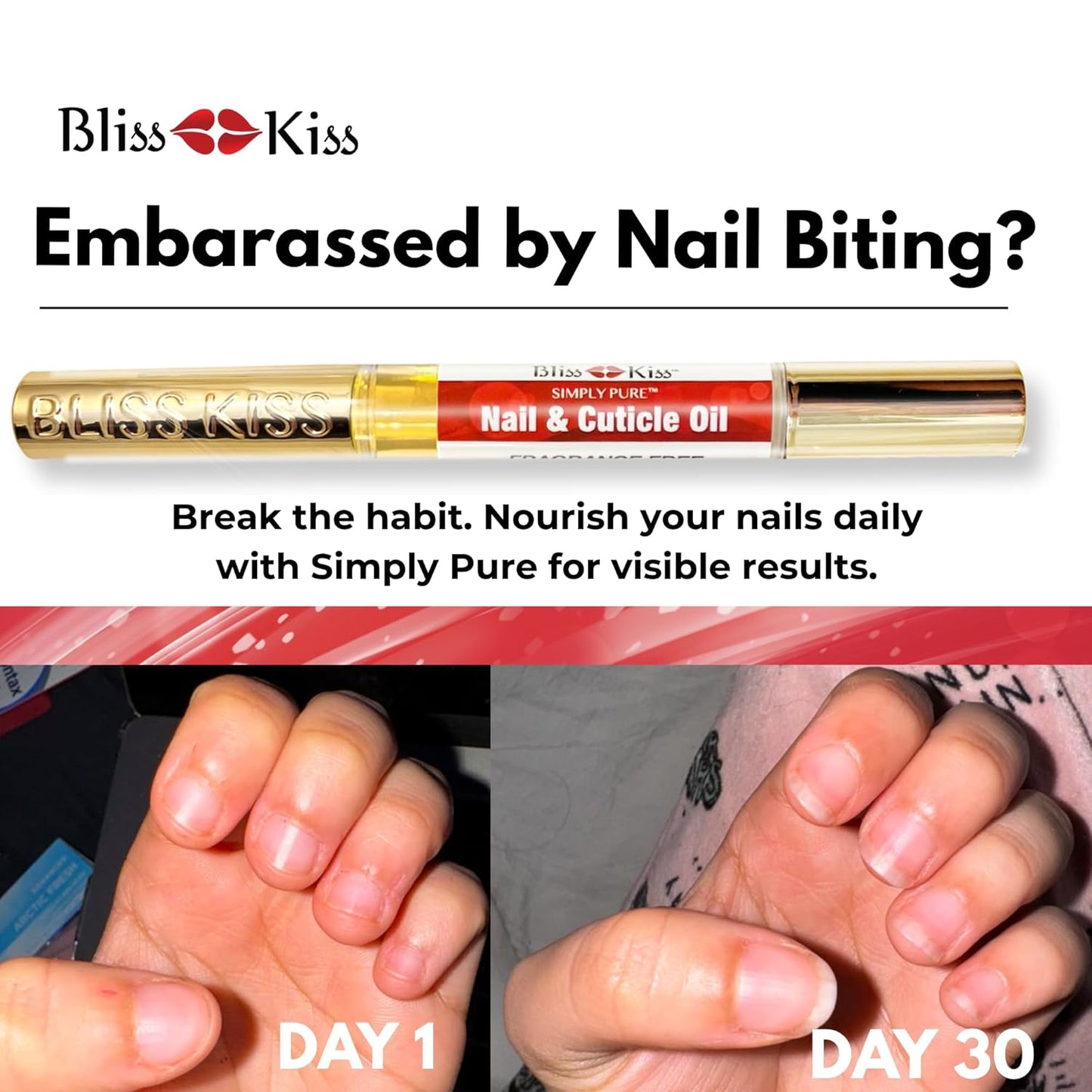 Bliss Kiss | 1 Candy Cane Fragrance | Nail Oil Cuticle Pen w/Vitamin E & Jojoba⏤Nail Strengthener Nail Growth Serum for Brittle Peeling Breaking Thin Nails-Velvo Beauty