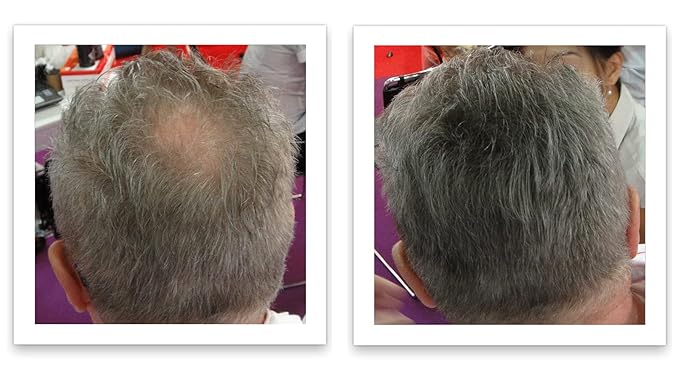 Trial Size - Make Thin Hair Look 10X Fuller. Eliminate Bald Spot and Thinning Hair Instantly. All-Natural Hair Concealer. Salt & Pepper - Light-Velvo Beauty